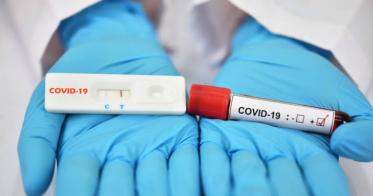 50 AED PCR Test