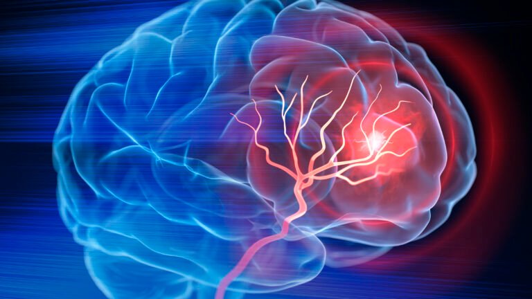 Stem Cell Transplants 